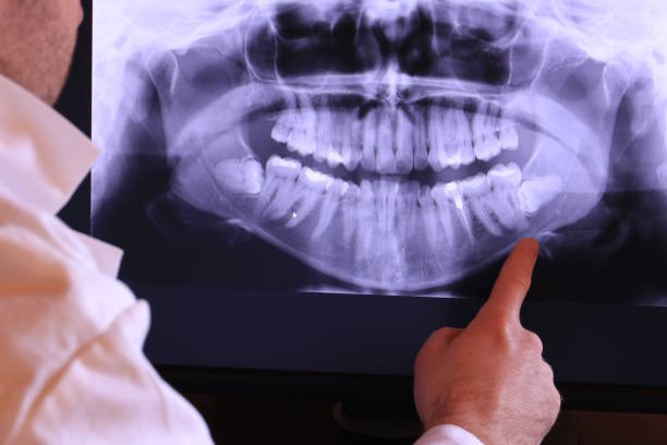 Best Emergency Dentist for Knocked-Out Tooth in Worth, IL